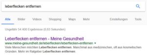 SEO Suchmaschinenoptimierung Onpage-Optimierung Leberflecken entfernen